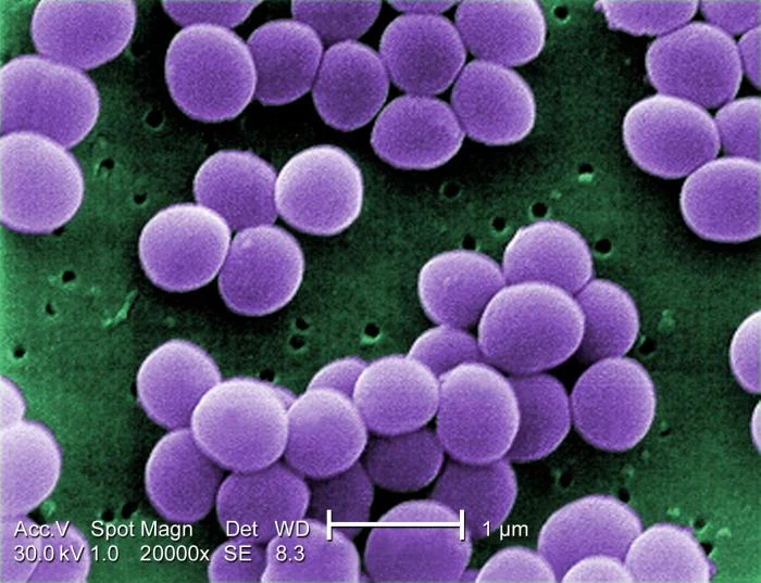Cellules sphériques de Staphylococcus aureus regroupées sur une micrographie colorisée